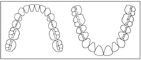 Gebiss-Abbildung (30 x 70 mm)